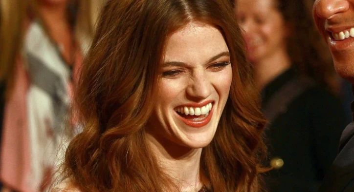 Proměna zubů Rose Leslie – Před a Po