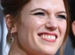 Rose Leslie Teeth Transformation – Before & After