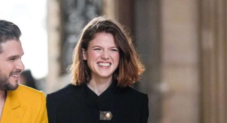 Rose Leslie Zähne Transformation – Vorher & Nachher