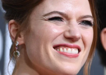 Трансформация зубов Rose Leslie – До и После