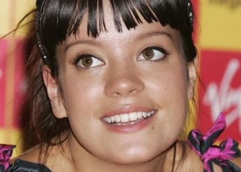 Трансформация зубов Lily Allen: до и после