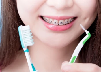 Braces Cleaning Guide: Tools, Kits, Routines & Safety