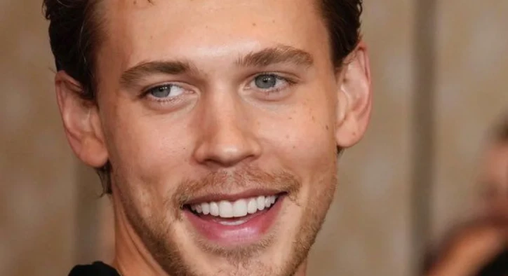 Austin Butlers Zähne: Vorher & Nachher, Transformation & Veneers