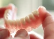 What Are Hybrid Dentures? Types, Benefits, Implants vs. Cost Guide