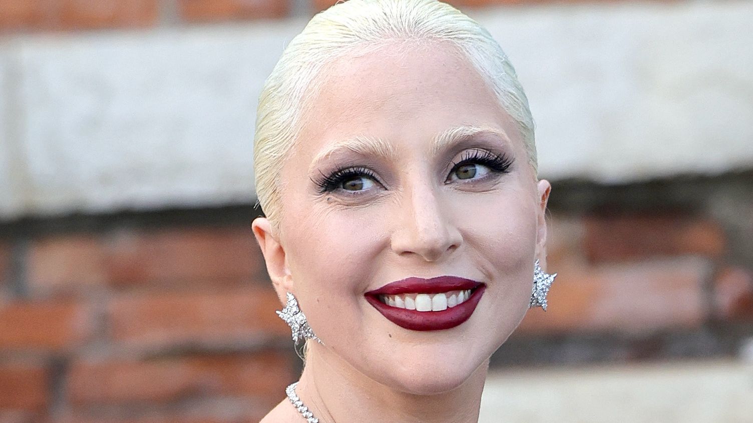 Lady Gaga Teeth: Teeth Gap, Braces & Smile Transformation