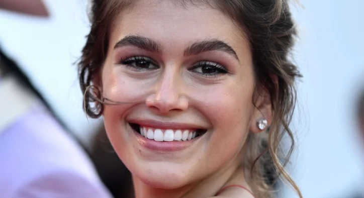 Zuby Kaii Gerber: Fotky před a po, fasety a úsměv