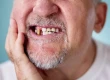 Trench Mouth: Symptoms, Causes, Treatment & Prevention