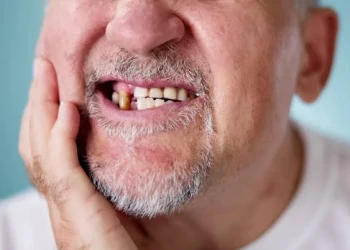 Trench Mouth: Symptoms, Causes, Treatment & Prevention