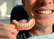 Flipper Tooth: Eating, Insertion, Sleeping & Temporary