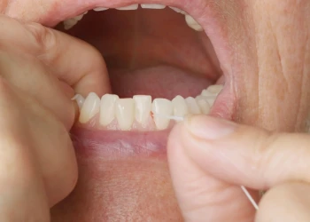 Bleeding Gums When Flossing: Causes, Fixes & Pregnancy